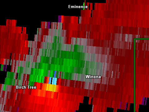 Radar/Photo